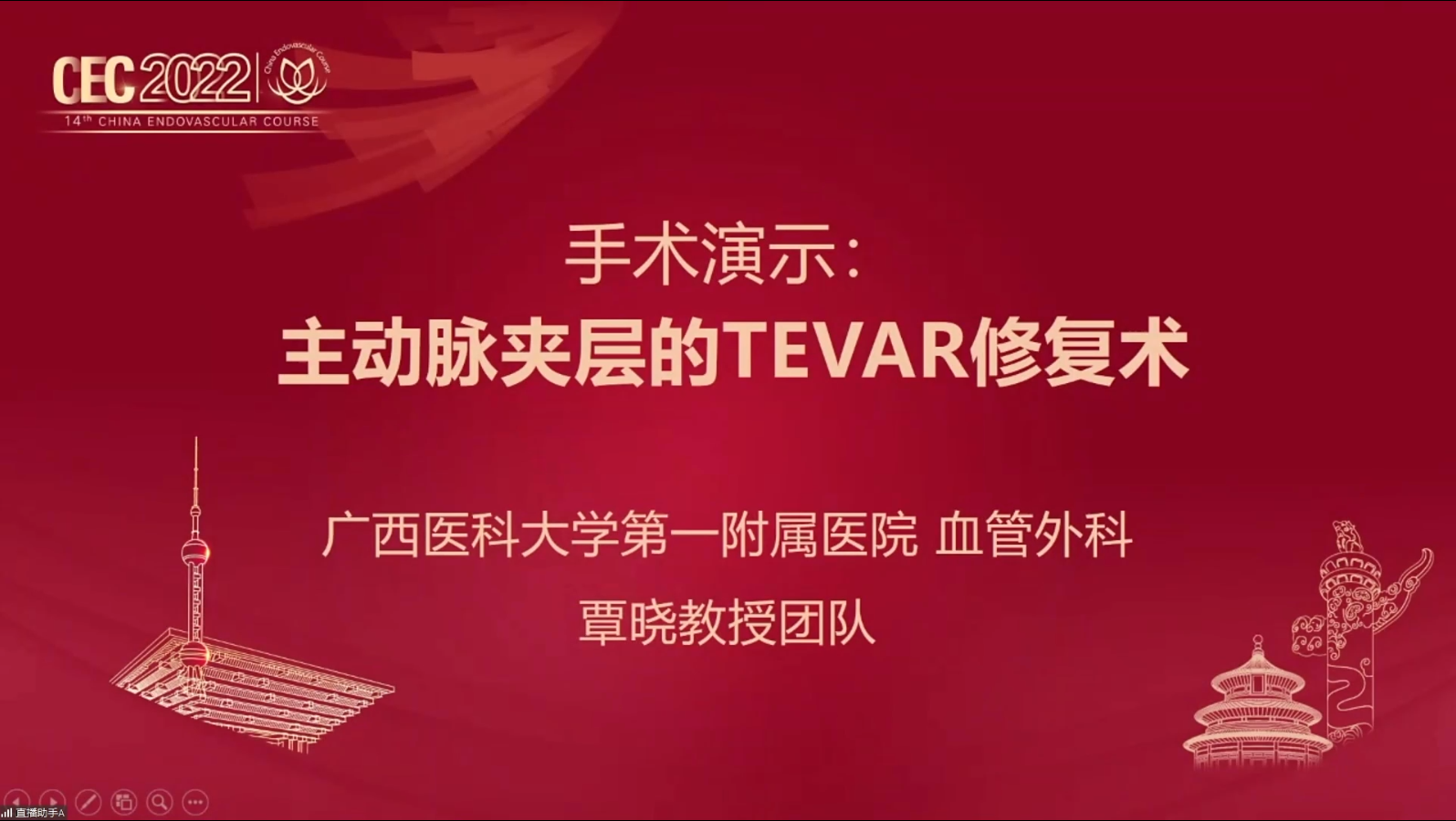 主动脉夹层TEVAR修复术-覃晓