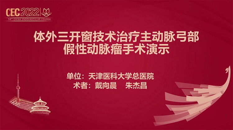 体外三开窗技术治疗主动脉弓部假性动脉瘤手术演示-戴向晨 