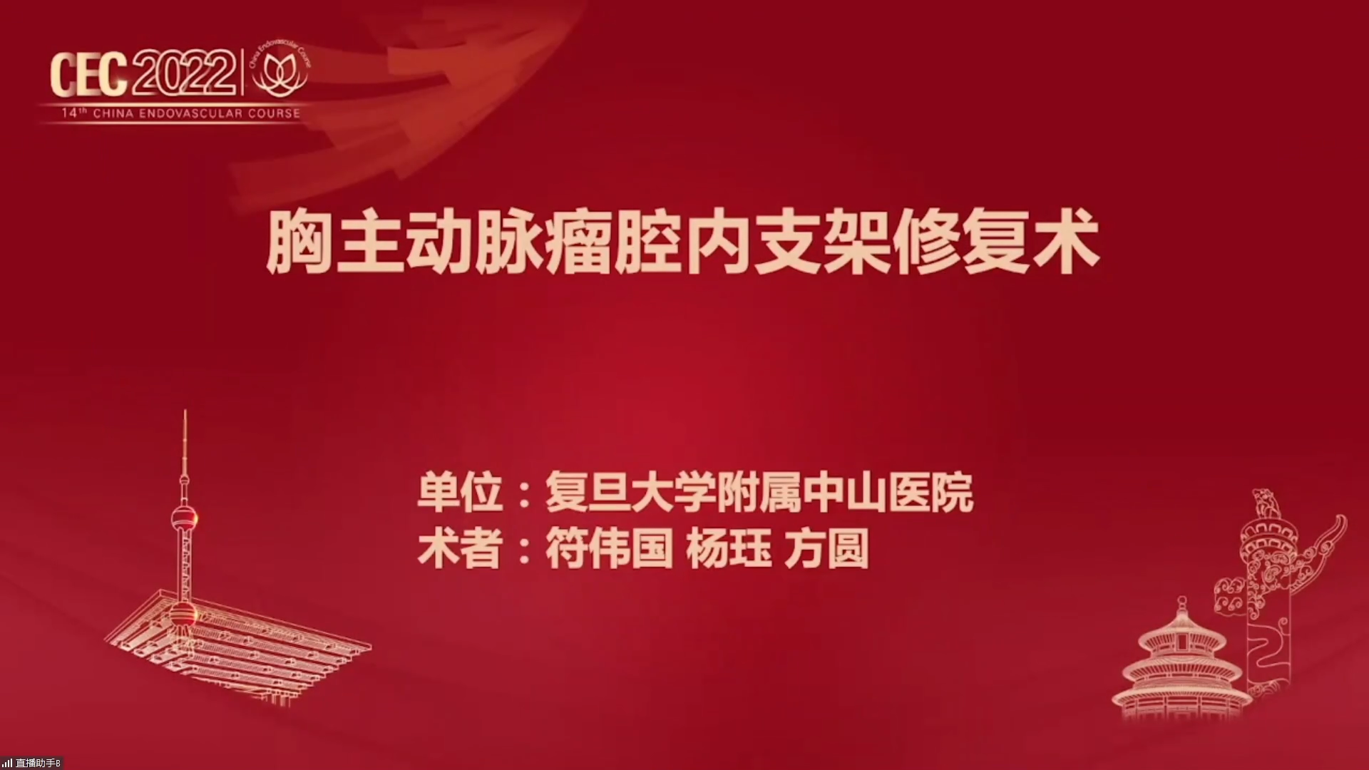 胸主动脉瘤腔内支架修复术-符伟国 杨珏