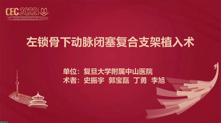 左锁骨下动脉闭塞复合支架植入术-史振宇-高斌