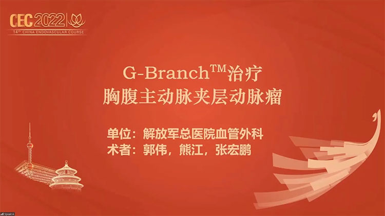 胸腹主动脉分支支架治疗胸腹主动脉夹层动脉瘤-郭伟，熊江