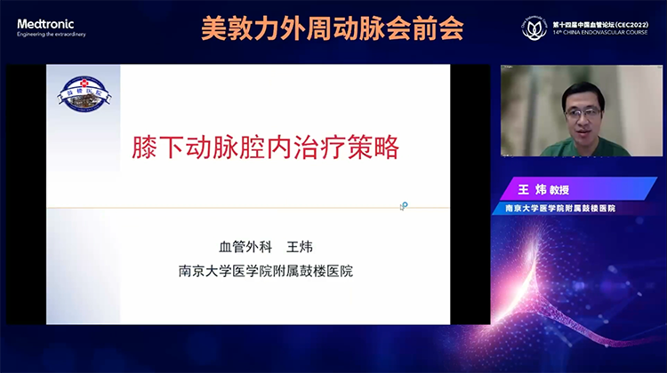 膝下动脉腔内治疗策略-王炜