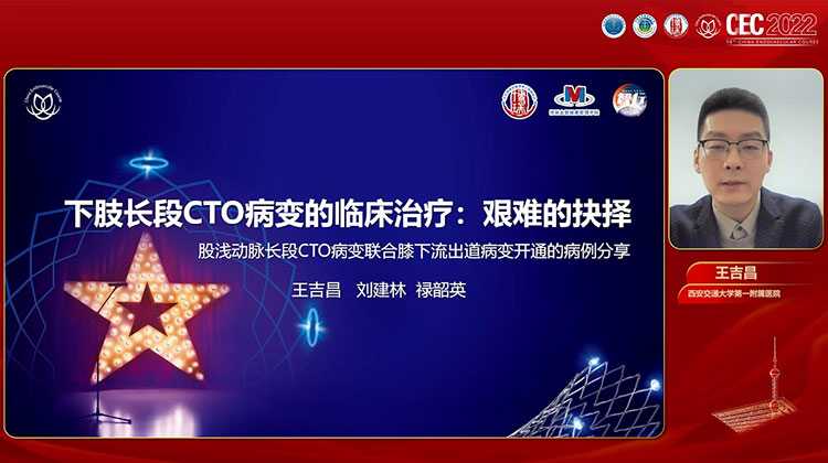 下肢长段CTO病变的临床治疗：艰难的抉择-王吉昌