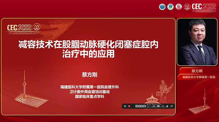 减容技术在下肢动脉硬化闭塞症腔内治疗中的应用-蔡方刚