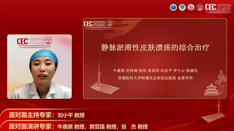 静脉淤滞性皮肤溃疡的综合治疗-牛鹿原