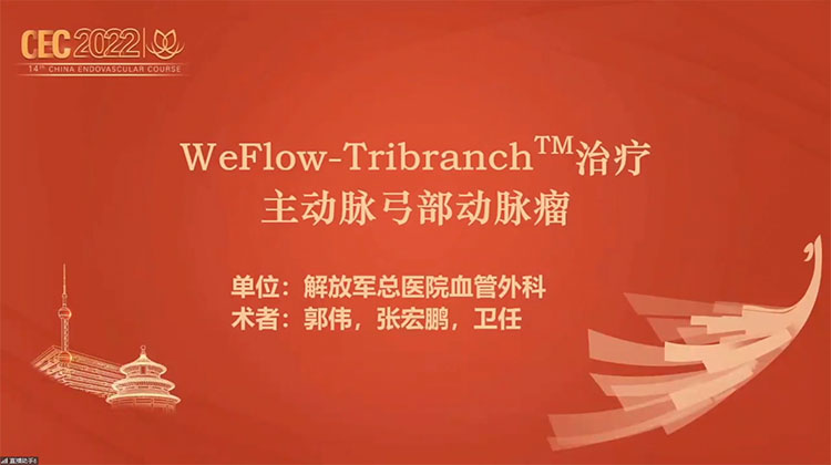 WeFlow-Tribranch&trade;治疗主动脉弓部动脉瘤-郭伟，张宏鹏
