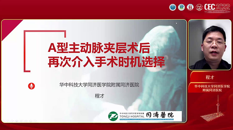 A型夹层术后灌注不良的介入处理时机-程才