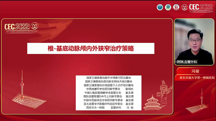 椎-基底动脉颅内外狭窄处理策略-冯骏