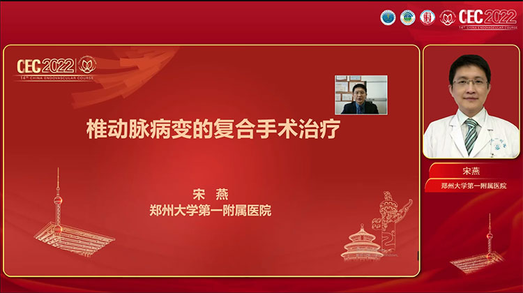 椎动脉病变的复合手术治疗-宋燕