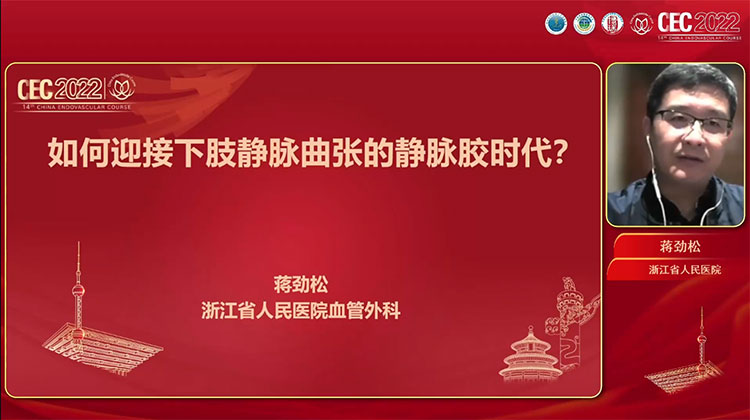 如何迎接下肢静脉曲张的静脉胶时代-蒋劲松