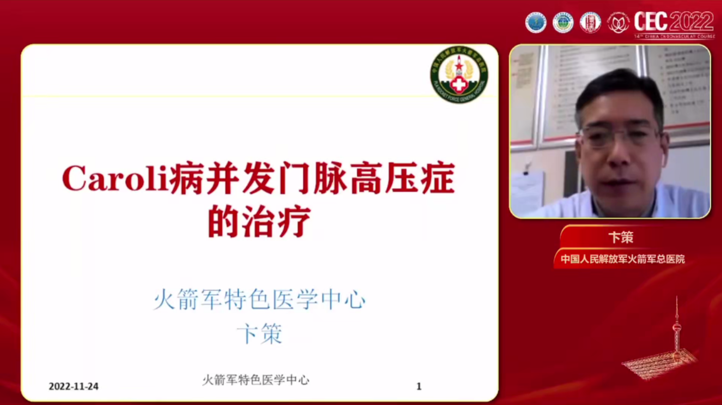 Caroli病合并门脉高压症的外科诊治-卞策