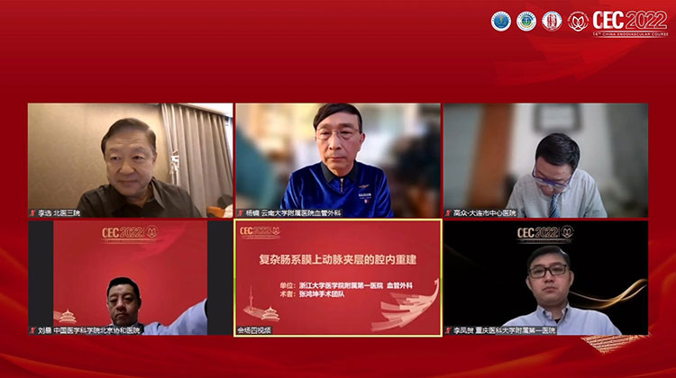 复杂肠系膜上动脉夹层的腔内重建-张鸿坤