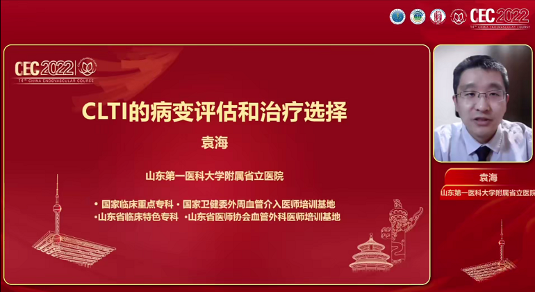 CLI的病变评估和治疗选择-袁海