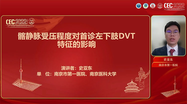 髂静脉受压程度对首诊左下肢DVT病变特征的影响-史亚东