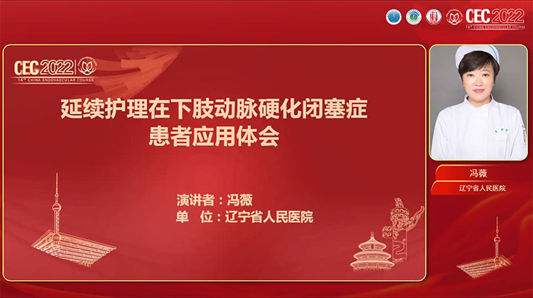 延伸护理服务在下肢动脉硬化闭塞症患者中应用-冯薇