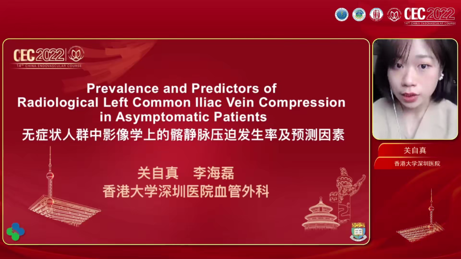 无症状人群中影像上的髂静脉压迫发生率及预测因素-关自真