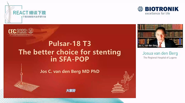Pulsar-18 T3 The better choice for stenting in SFA-POP-Josua van den Berg