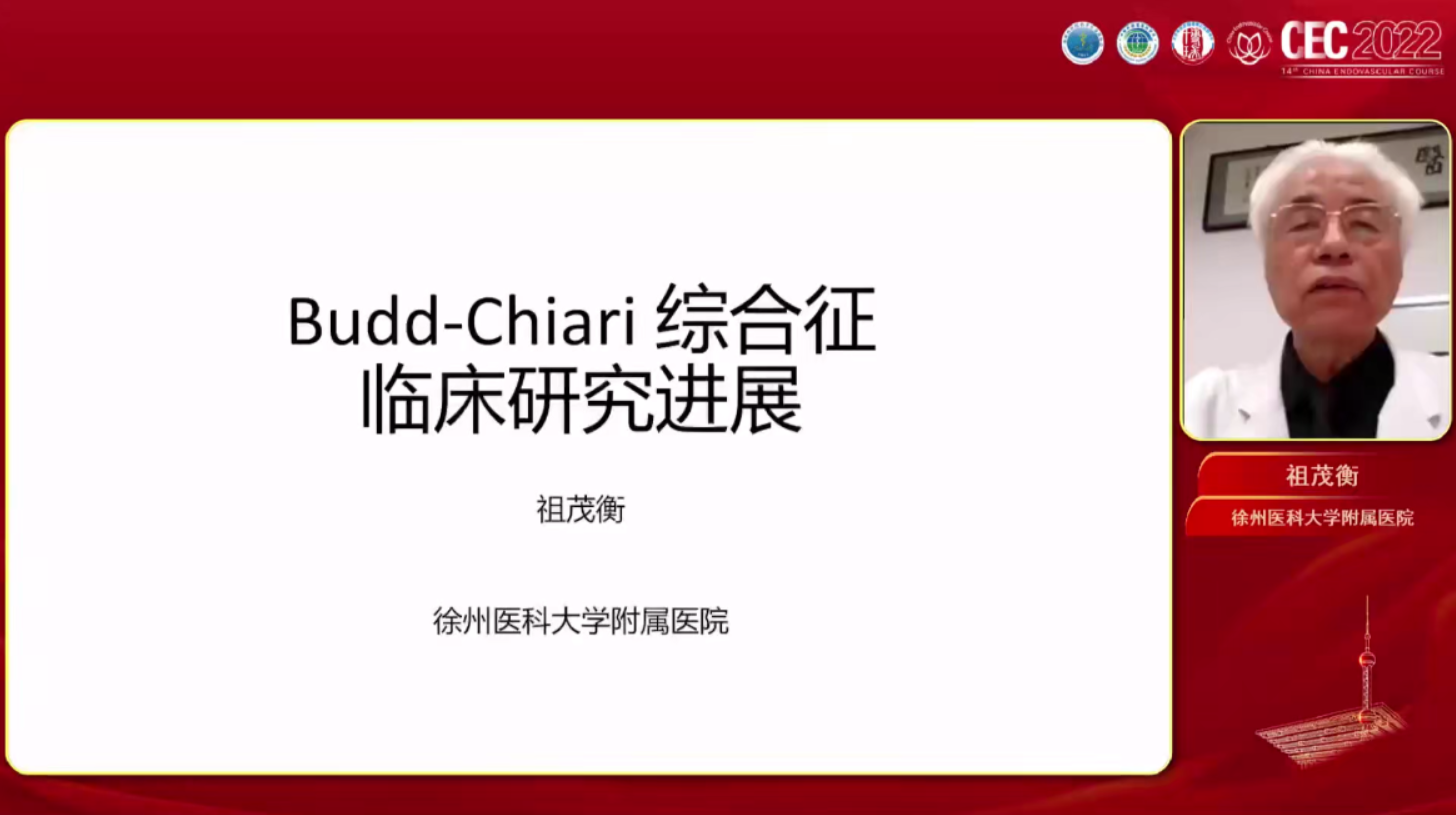 Budd-Chiari syndrome临床研究进展-祖茂衡