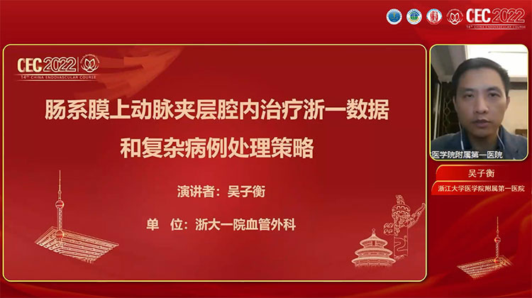 肠系膜上动脉夹层腔内治疗浙一数据和复杂病例处理策略-吴子衡