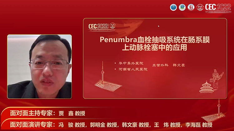 Penumbra血栓抽吸系统在肠系膜上动脉栓塞治疗中的应用-韩文豪