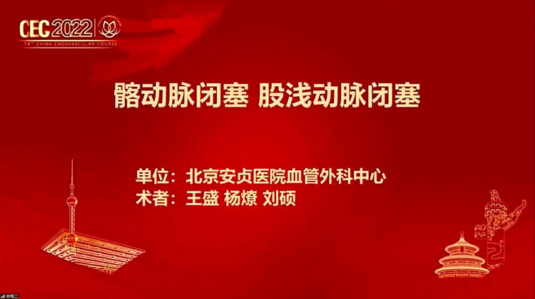 髂动脉闭塞-股浅动脉闭塞-王盛-杨燎