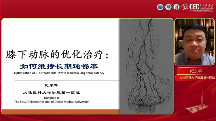 膝下动脉的优化治疗如何维持长期通畅率-纪东华