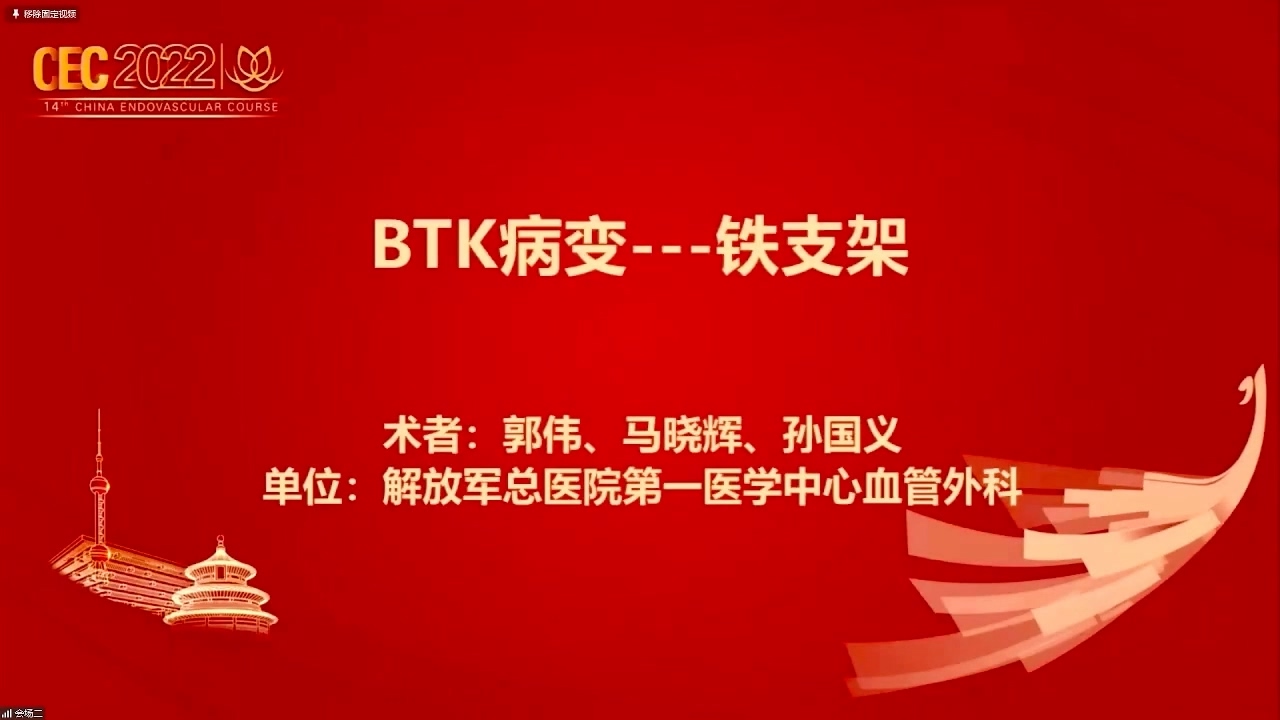 BTK病变---铁支架-马晓辉 孙国义