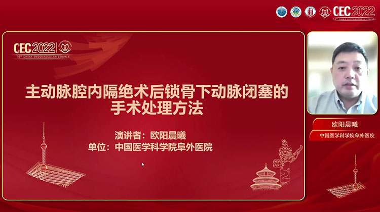 主动脉腔内隔绝术后锁骨下动脉闭塞的手术处理方法-欧阳晨曦