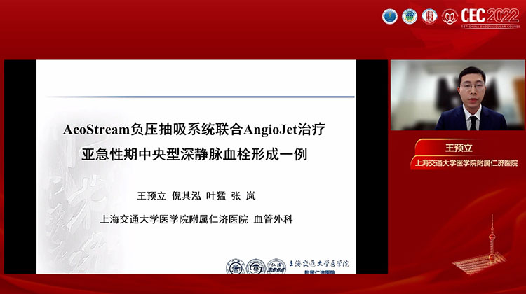 优势互补 Acostream负压抽吸系统联合AngioJet治疗中央型深静脉血栓一例-王预立