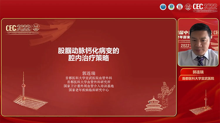 股腘动脉钙化病变的腔内治疗策略-郭连瑞