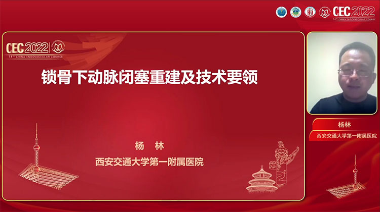 锁骨下动脉闭塞治疗原则-杨林