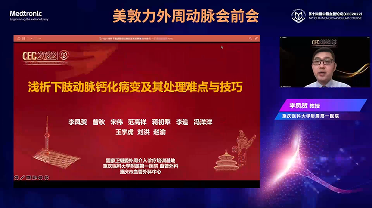 浅析下肢动脉钙化病变及其处理难点与技巧-李凤贺