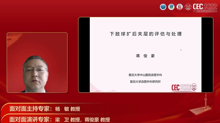 下肢球扩后夹层的评估与处理-蒋俊豪