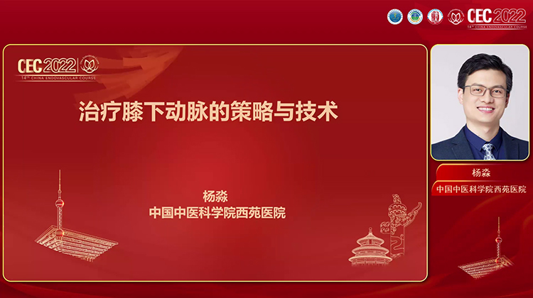 膝下动脉开通策略-杨淼