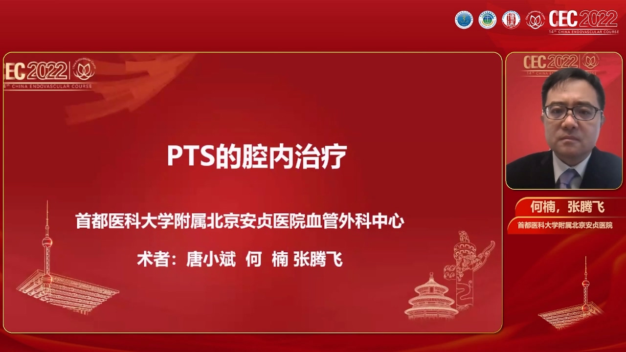 PTS的腔内治疗-何楠 张腾飞