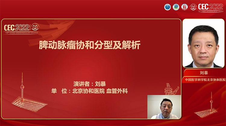 脾动脉瘤协和分型及解析-刘暴