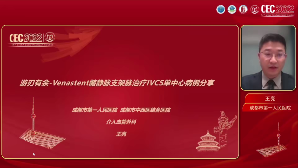 Venastent支架在髂静脉压迫综合征中的应用-王亮