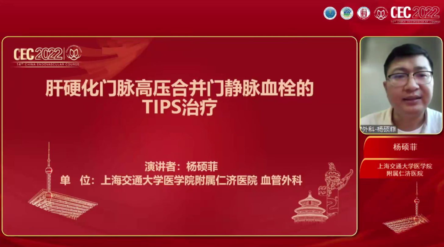 肝硬化门脉高压合并门静脉血栓的TIPS治疗-杨硕菲