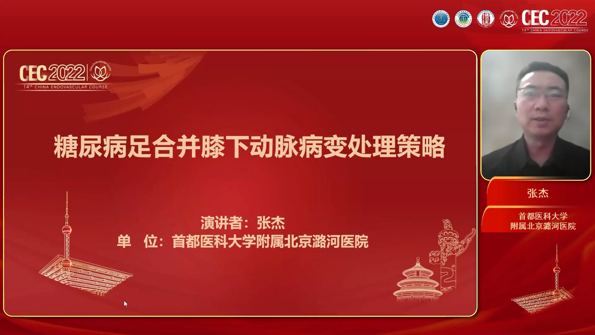 糖尿病足合并膝下动脉病变处理策略-张杰