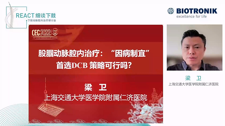 股腘动脉腔内治疗：&ldquo;因病制宜&rdquo; 首选DCB 策略可行吗？-梁卫