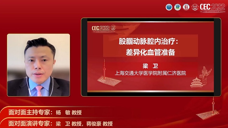 股腘动脉血管准备思考-梁卫