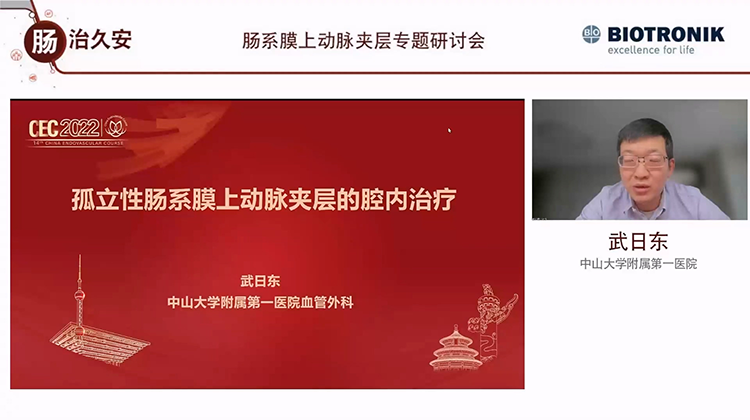 孤立性肠系膜上动脉夹层的腔内治疗-武日东