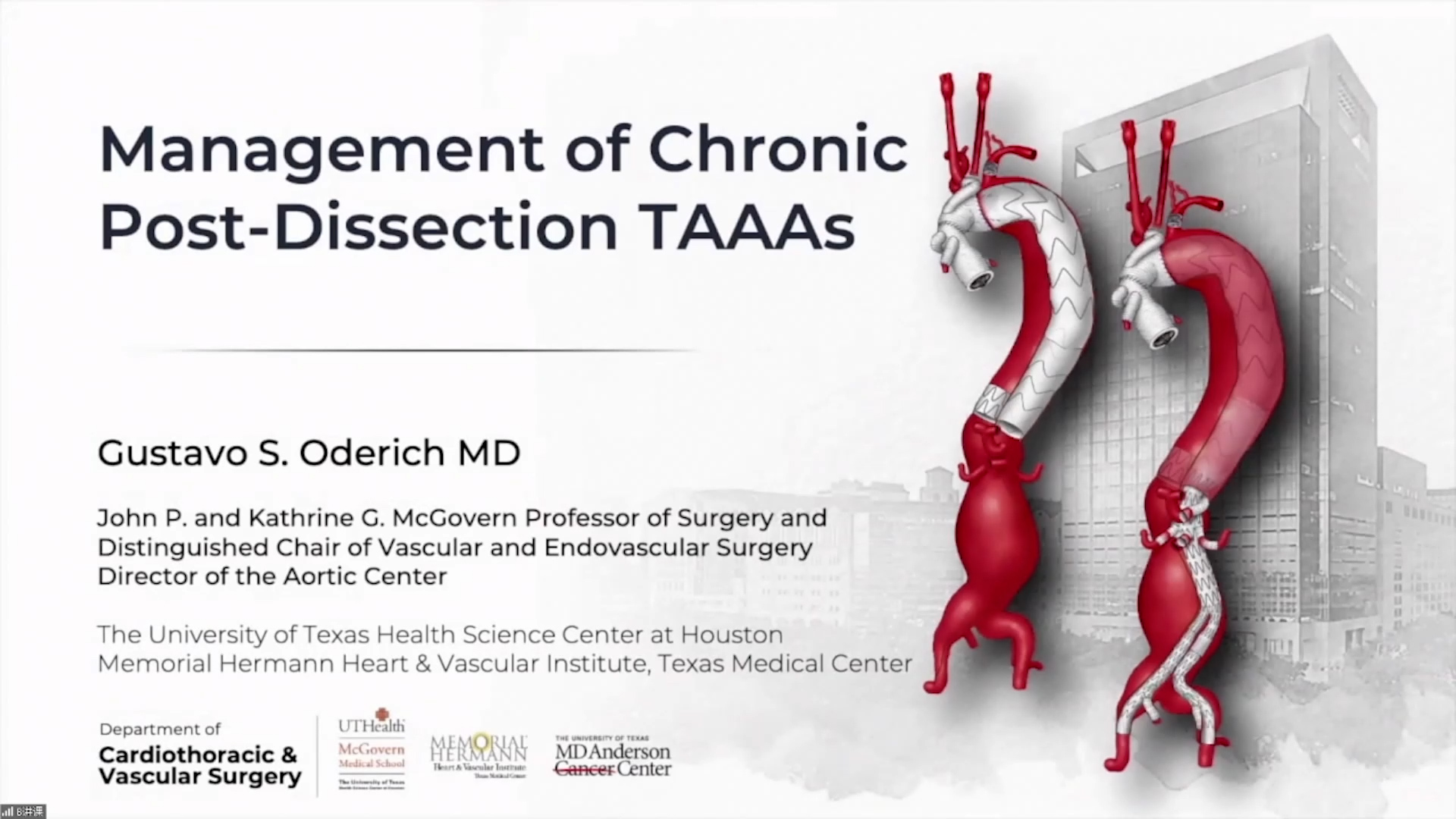Update on Chronic Dissection Thoracoabdominal Aneurysms-Gustavo Oderich
