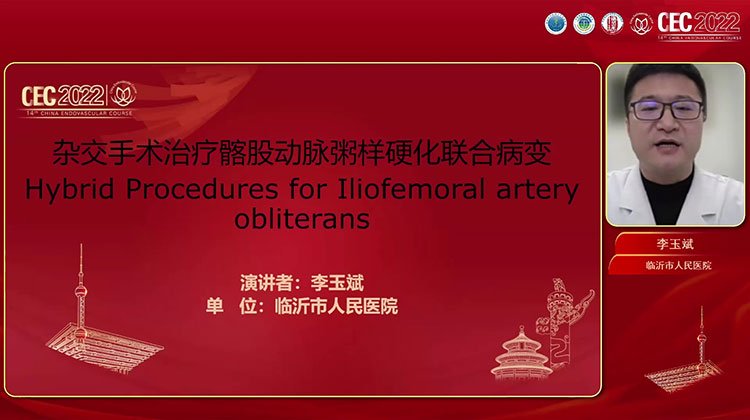 杂交手术治疗髂股动脉粥样硬化闭塞联合病变-李玉斌