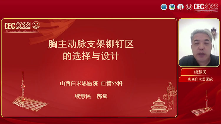 胸主动脉支架锚定区的选择和设计-续慧民