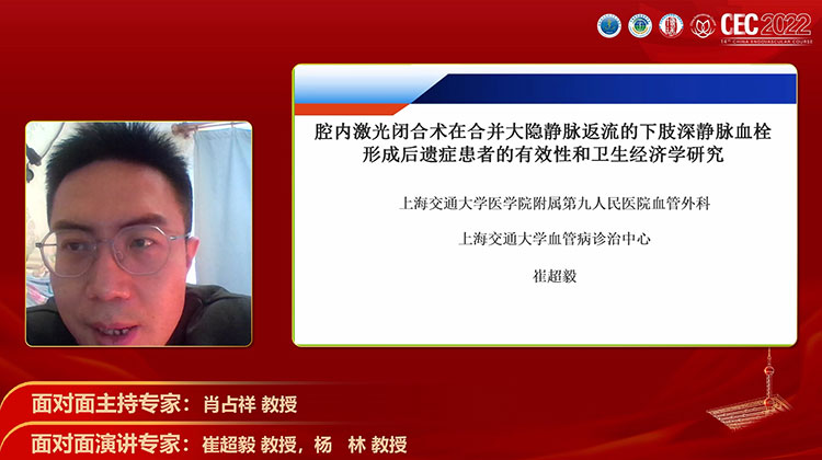 腔内激光闭合术在合并大隐静脉返流的下肢深静脉血栓形成后遗症患者的有效性和卫生经济学研究-崔超毅