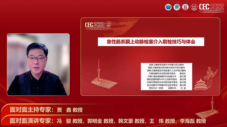 急性肠系膜上动脉栓塞介入取栓技巧与体会-冯骏