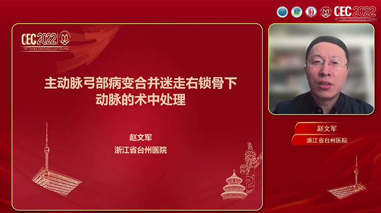 主动脉弓部病变合并迷走右锁骨下动脉的术中处理-赵文军