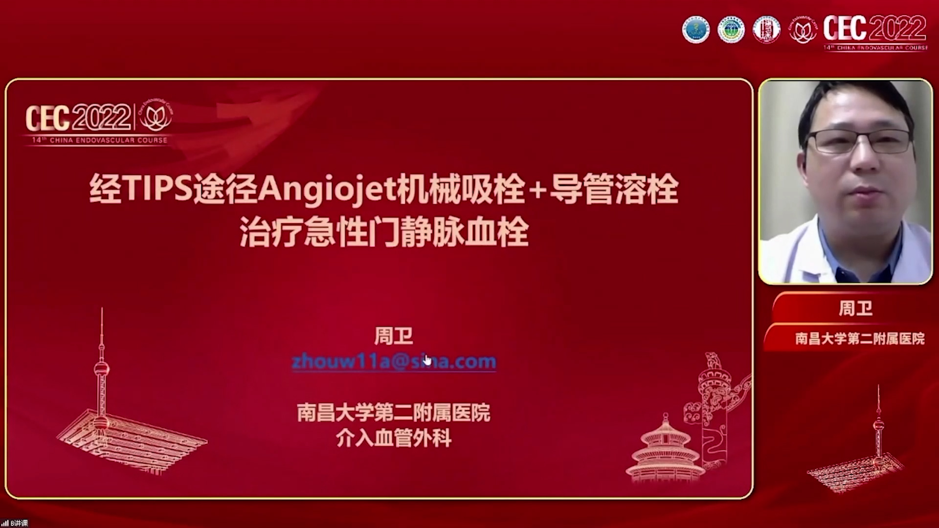 经TIPS入路机械吸栓及溶栓治疗急性门静脉血栓-祖茂衡