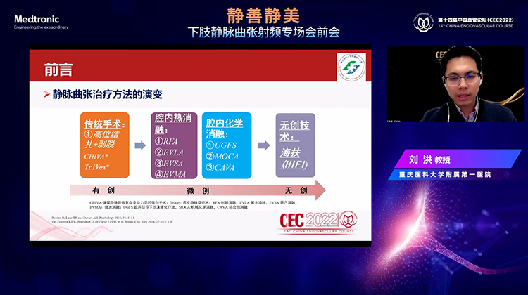 下肢静脉曲张治疗模式之演变-刘洪